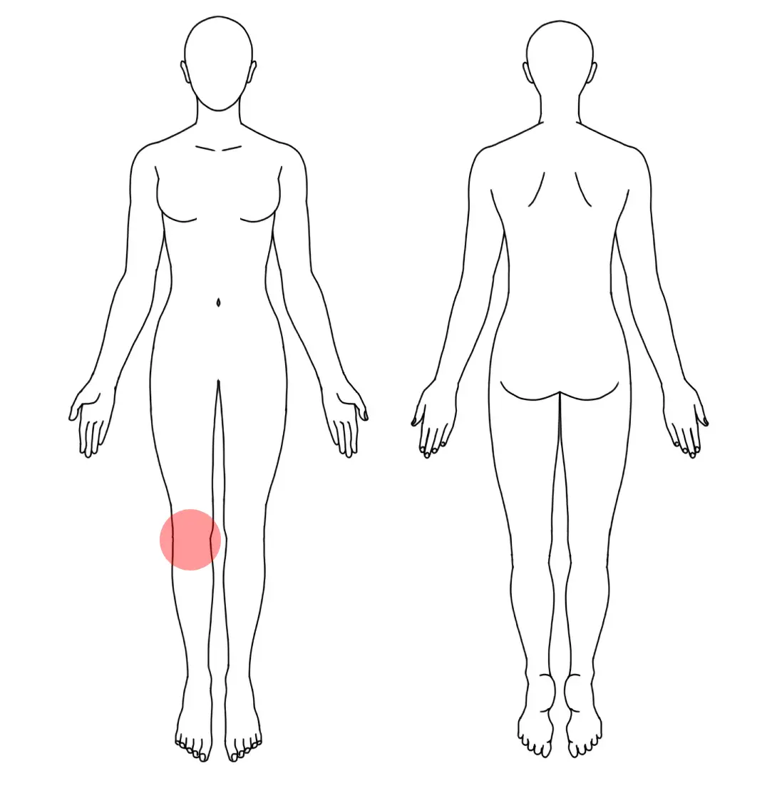 人体図（Ｙさんの右の膝痛）