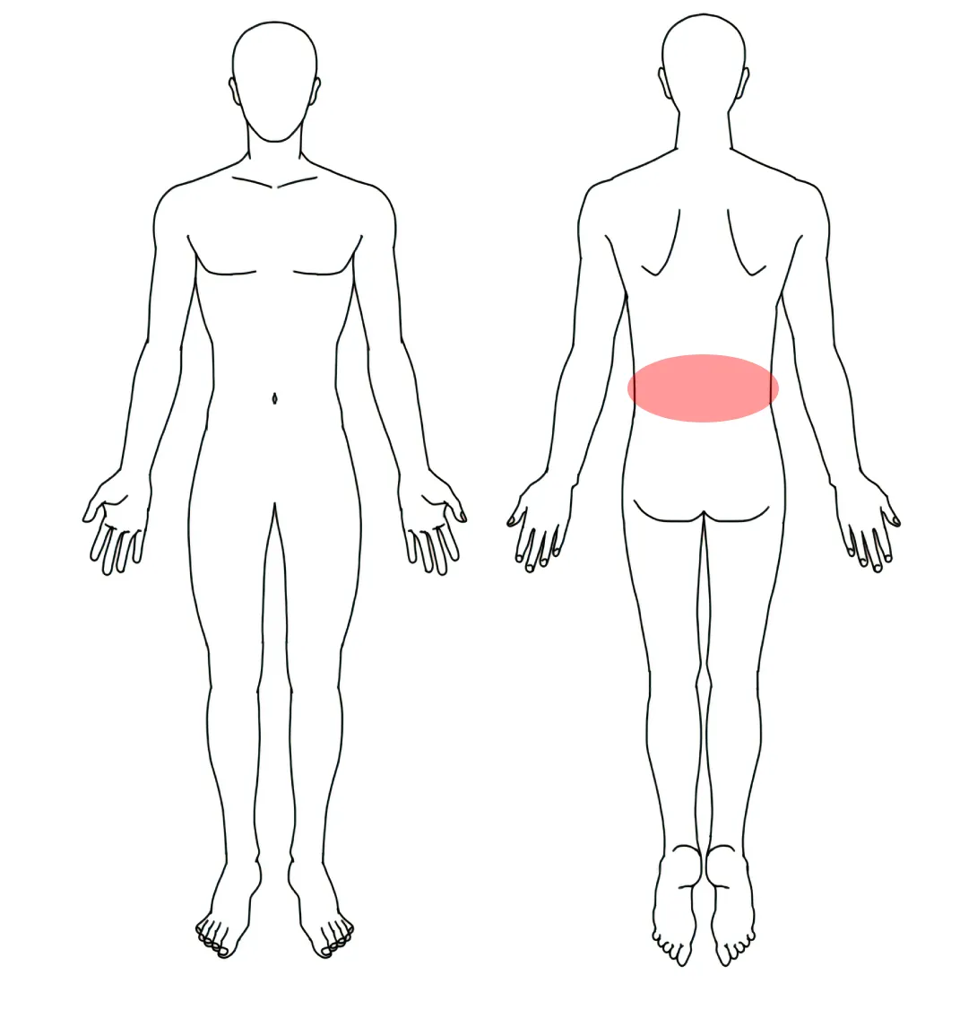 人体図（Hさんの腰全体の腰痛）