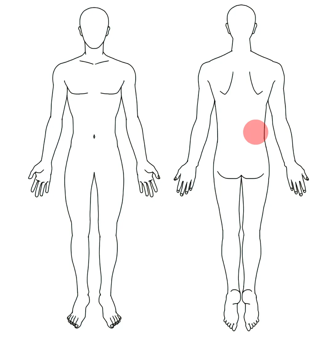 人体図（Ｎさんの右の寝起きの腰痛）