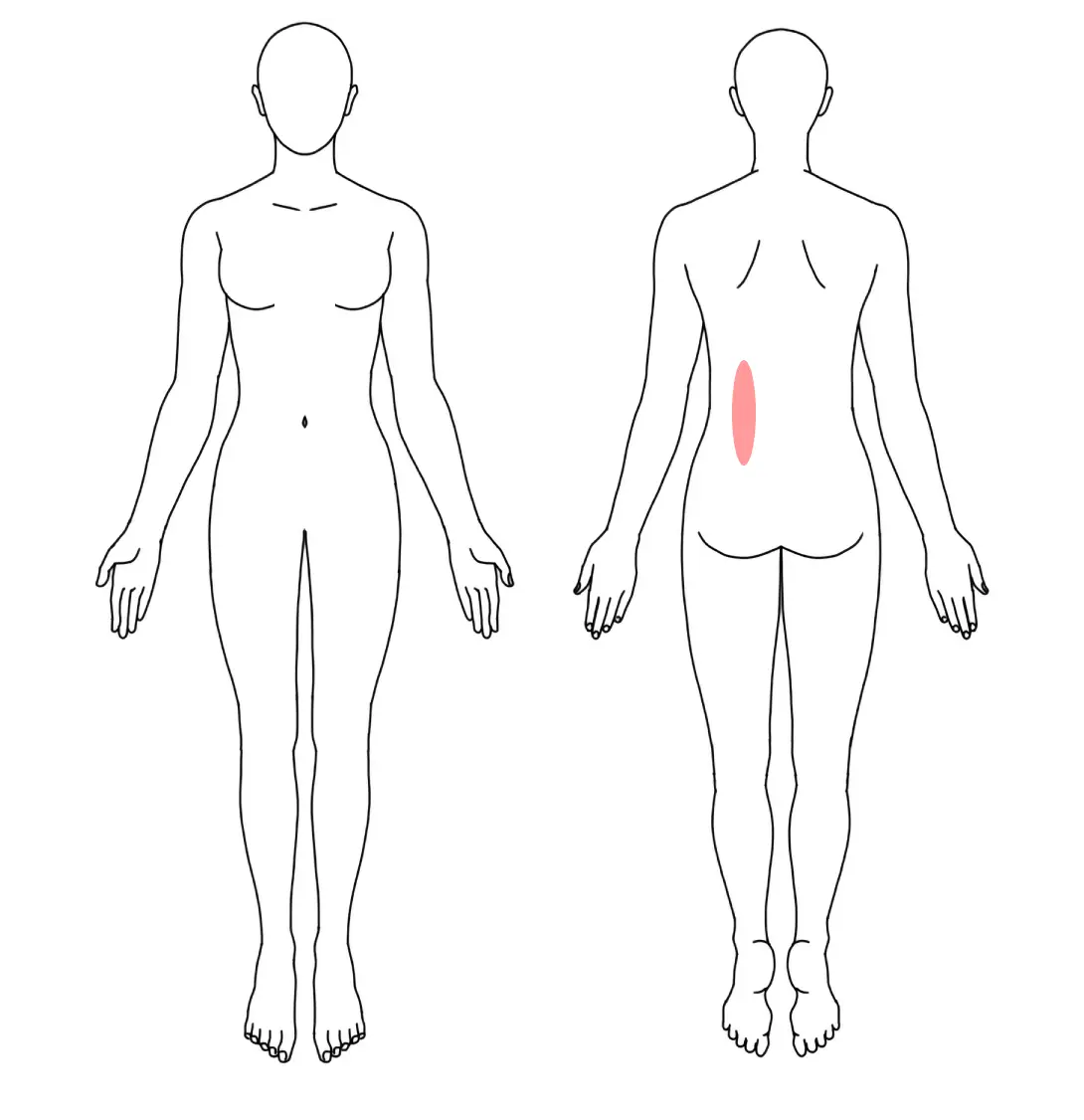 人体図（Ｙさんの左の腰痛）