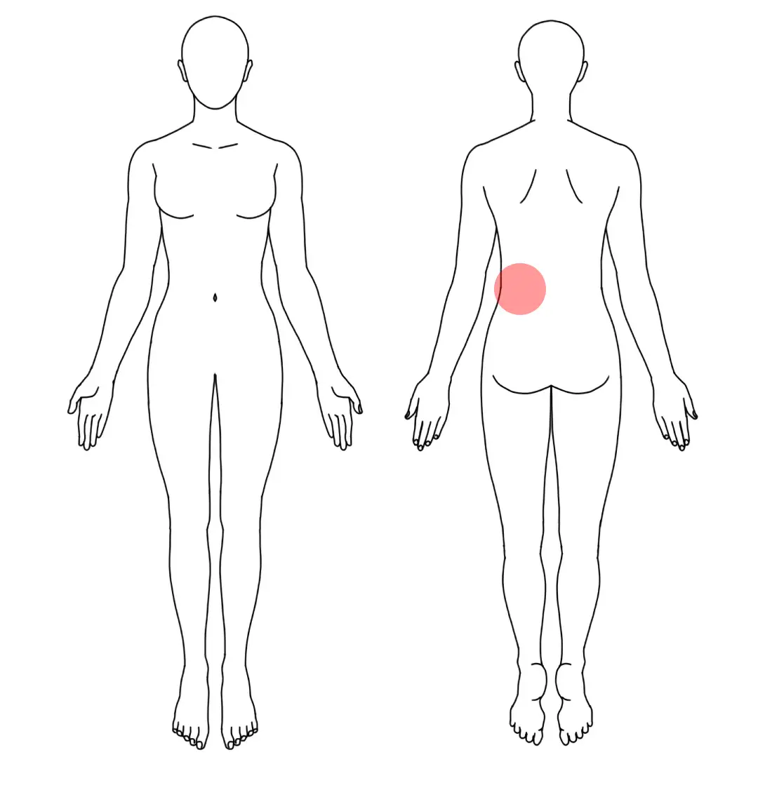 人体図（Ｋさんの左の産後の腰痛）